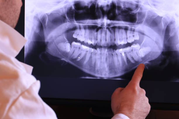 Best Emergency Dentist for Knocked-Out Tooth in Emory, VA